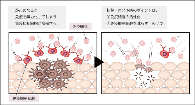 転移・再発予防のポイントは、1.免疫細胞の活性化、2.免疫抑制細胞を減らす、の2つ。