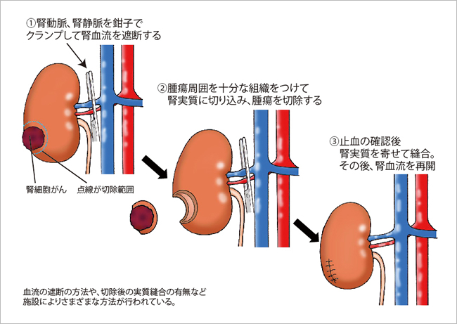 5. 私にどの治療法を勧めますか?