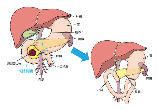 治療の見通し