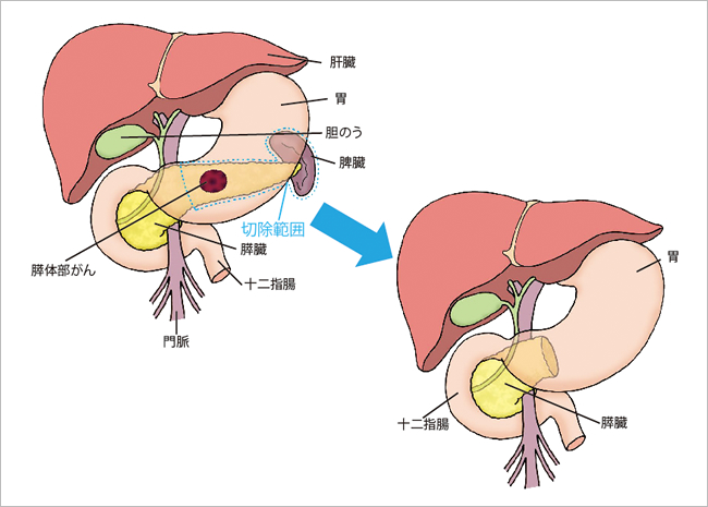 主な症状は何ですか?