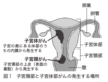 図１　子宮頸部と子宮体部がんの発生する場所
[子宮体がん]
子宮の奥にある体部のうちの内膜から発生する
[子宮頸がん]
子宮頸部の上皮（表面の細胞）から発生する