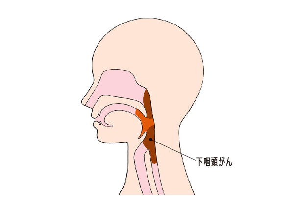 （図）下咽頭がんの位置