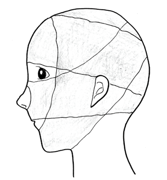 図1　頭頸部リンパ浮腫に対する圧迫帯の使用例