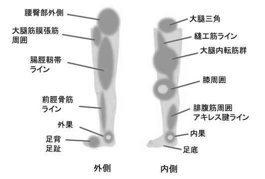 図1　線維化を生じやすい部位（下肢）